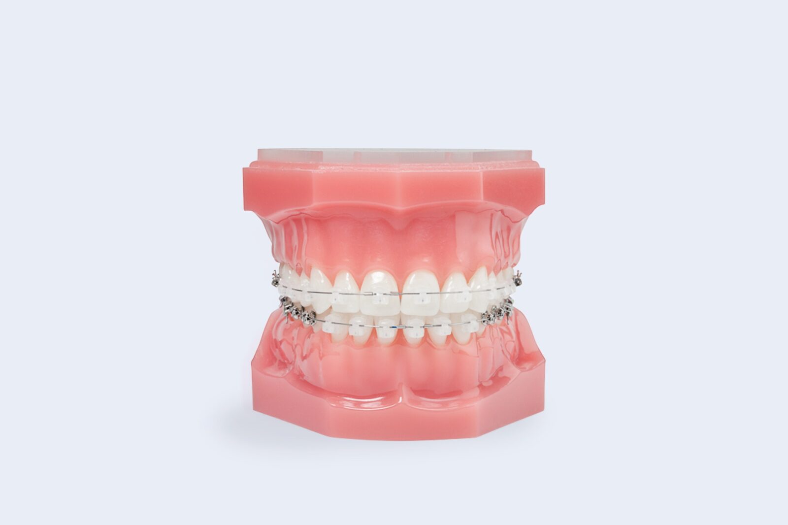 Clear Braces