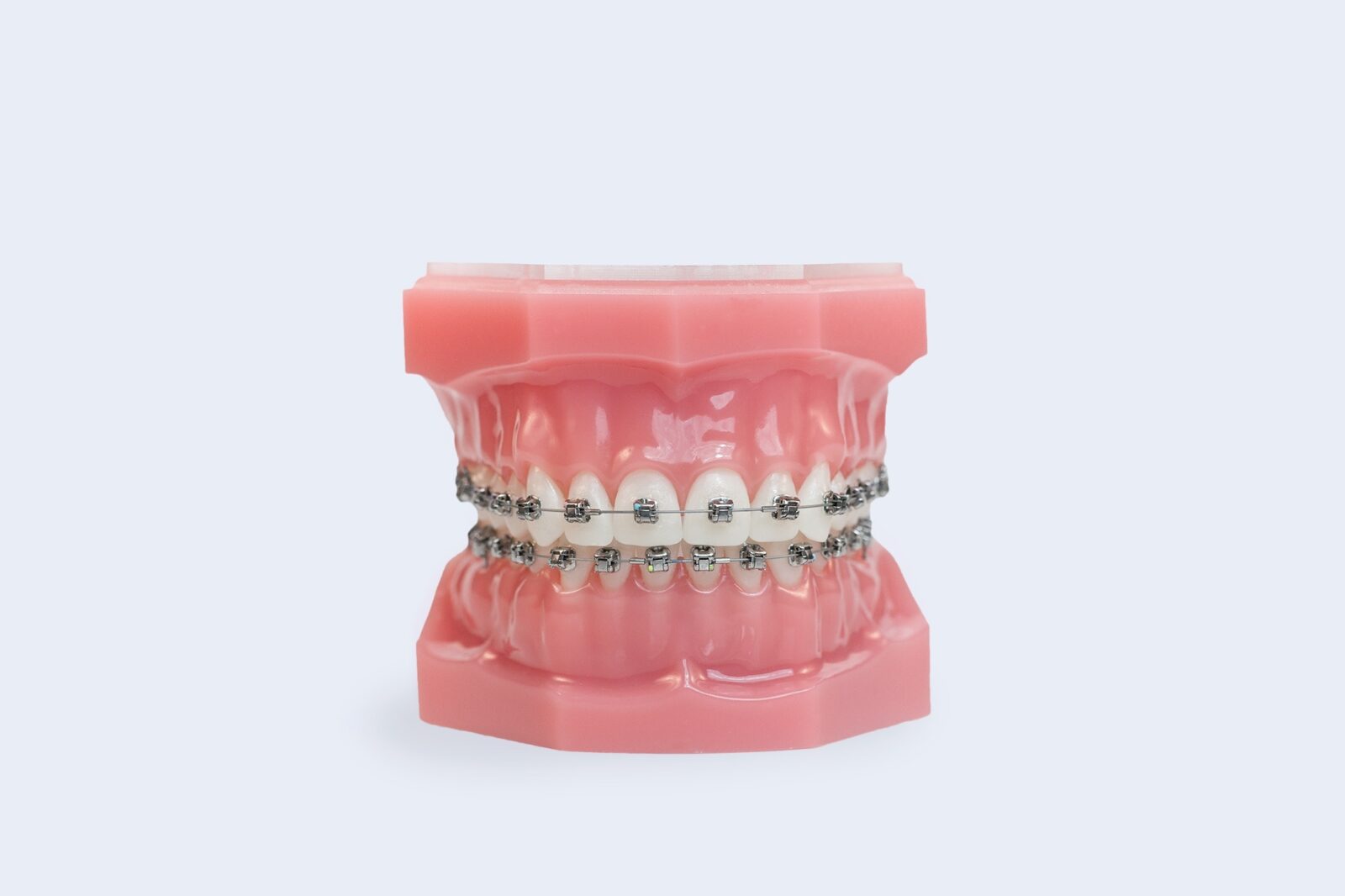 Metal Braces